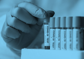 Test/pruebas para la detección de coronavirus covid-19 